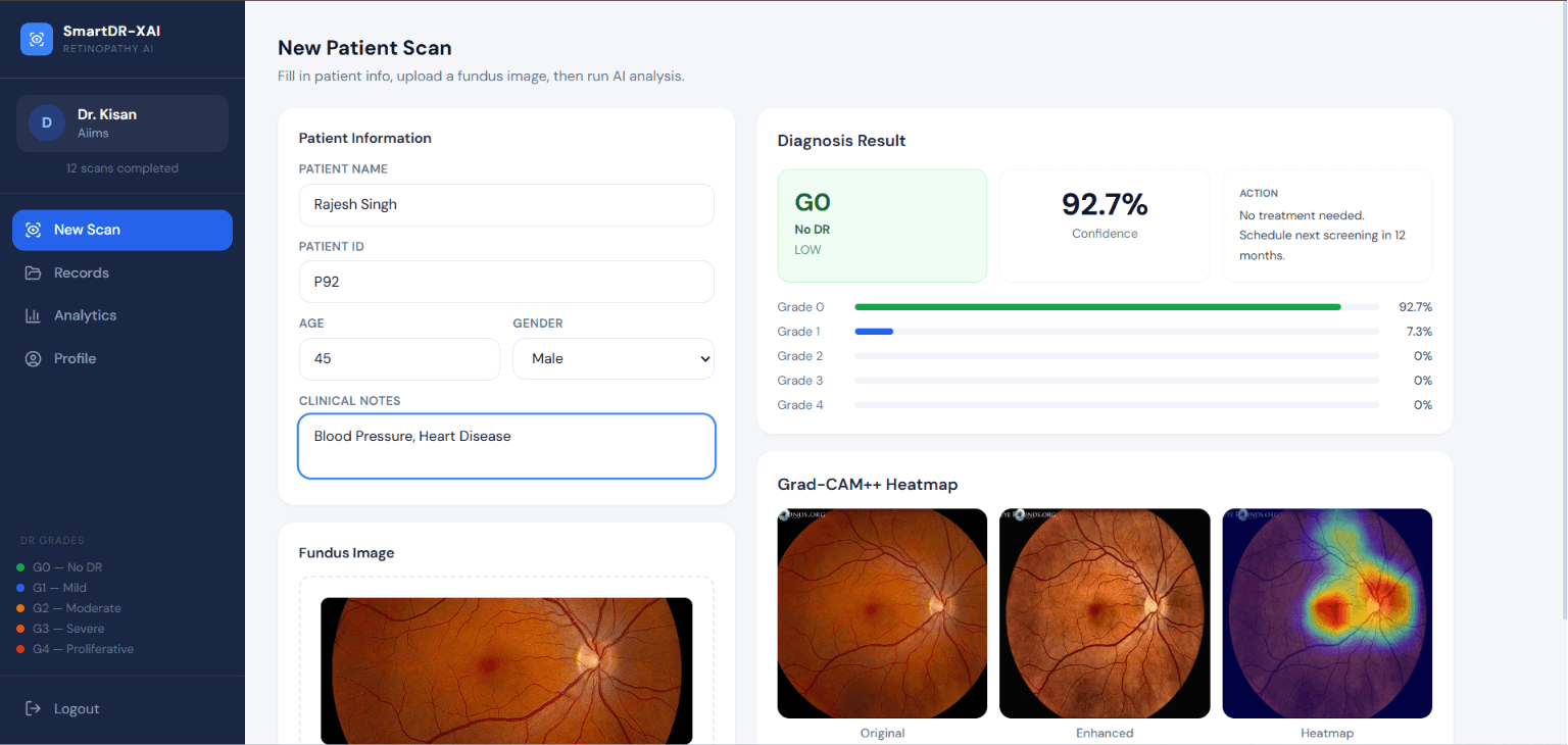 Smart Diabetic Retinopathy System preview